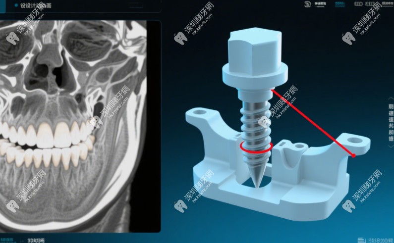 深圳羅湖區春風院區口腔科怎麼預約掛號www.hk.kelete.com