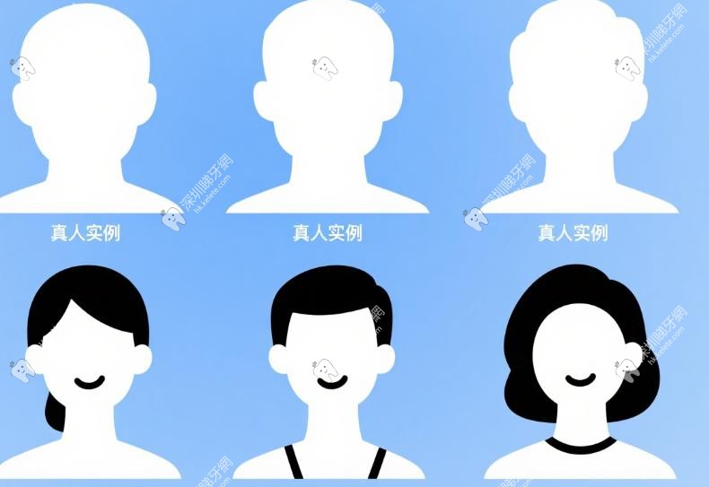 實例四：全口爛牙咬唔郁？伯伯「咬合重建」食翻甘蔗都得！