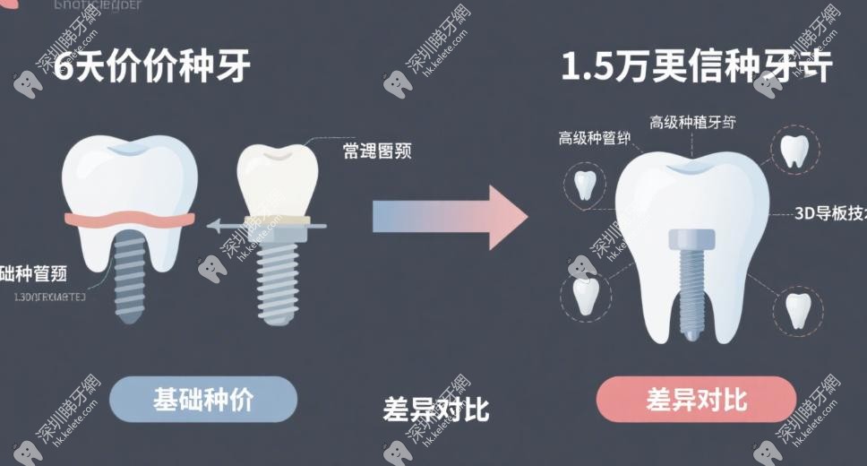 價差關鍵3：牙冠材料點樣影響終