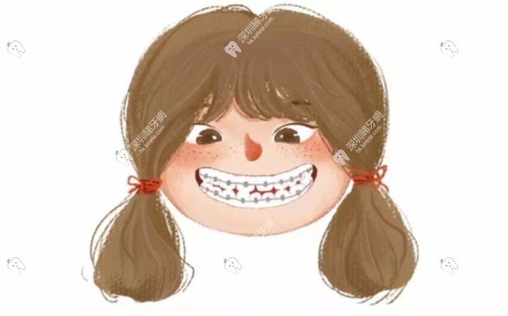 深圳正畸