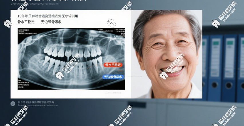 香港人在深圳看牙補助多少有优惠吗?有!香港長者醫療券單顆種牙直減¥7000,联系客服领满减!