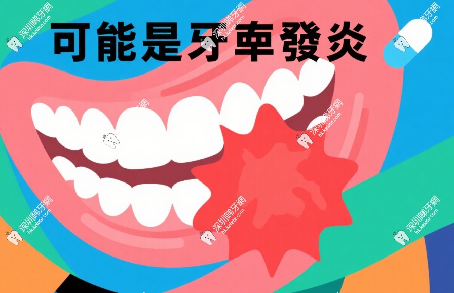 牙齒敲著痛哪些情況真的需要根管治療