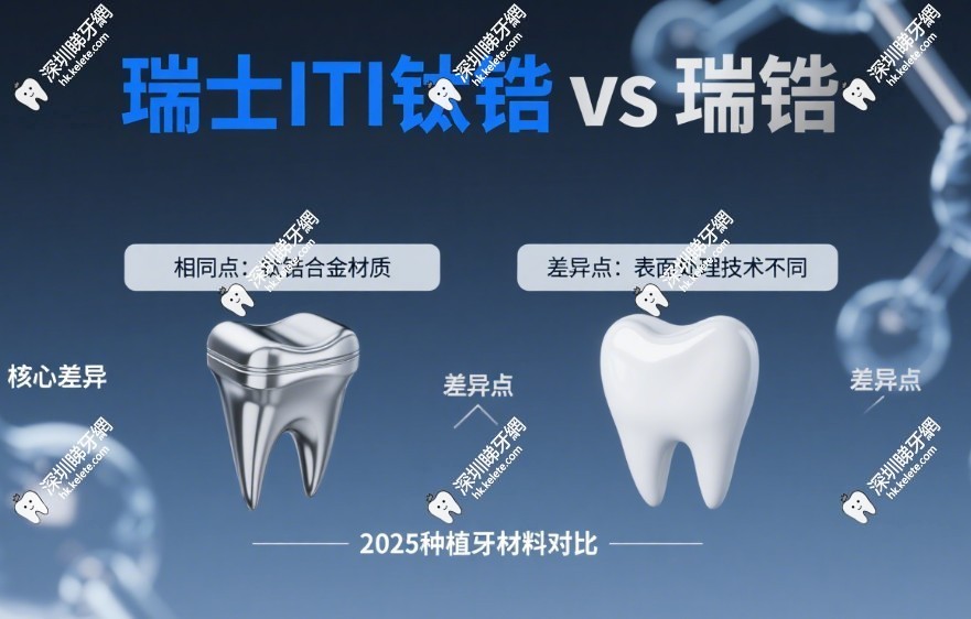 瑞士ITI鈦鋯和瑞鋯啥區別？材質都是鈦鋯合金，糖尿病種牙少等1個月