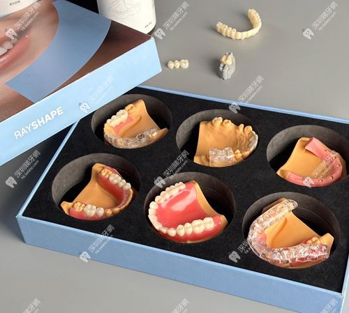 3D打印假牙比傳統假牙好嗎？3D打印假牙穩定性+咀嚼力提升40%（附臨床對比）