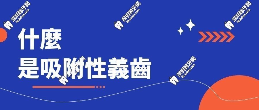 什麼是吸附性義齒