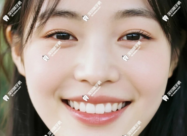 美塑樹脂和3M樹脂哪個好?六大區別在這裡,選對讓牙齒更健康