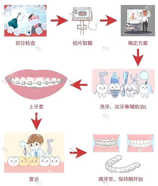牙齒矯正的核心流程 牙齒矯正的核心流程