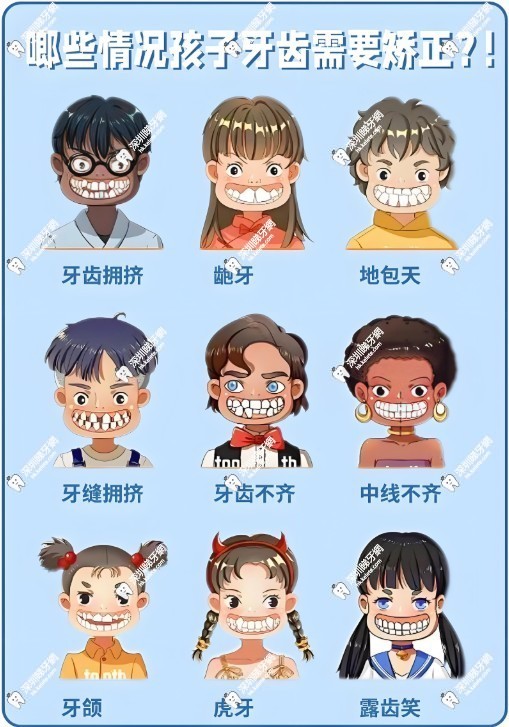 牙齒矯正的適用人群