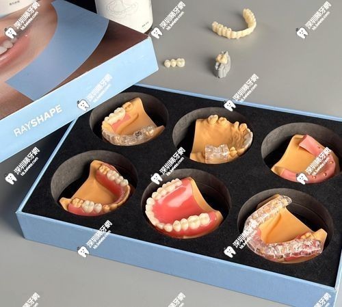 3D打印假牙比傳統假牙好嗎
