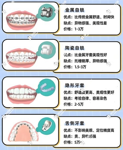 常見的牙齒矯正方式