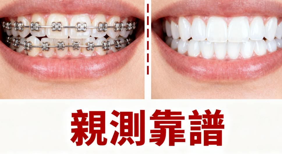 深圳銘德口腔矯正服務：
