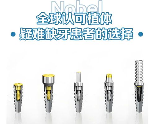 諾貝爾3.0窄直徑種植體好嗎