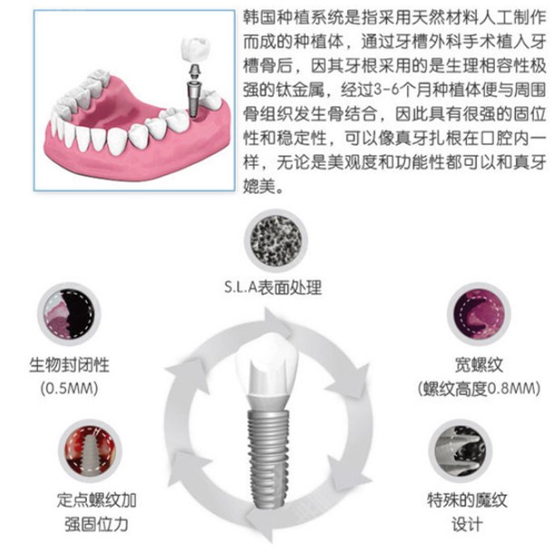 獲取種牙報價