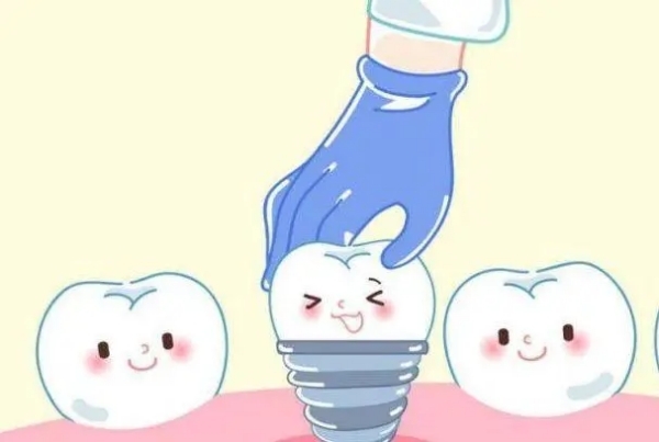 选登德玛或百齿泰的注意事项