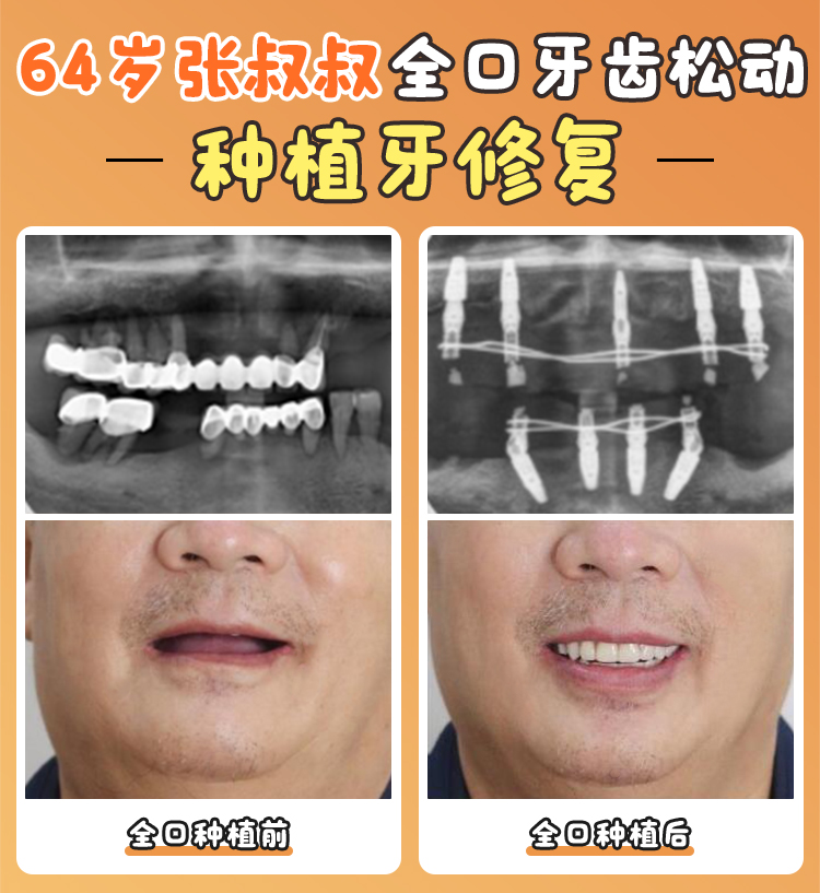 第一步：術前檢查
