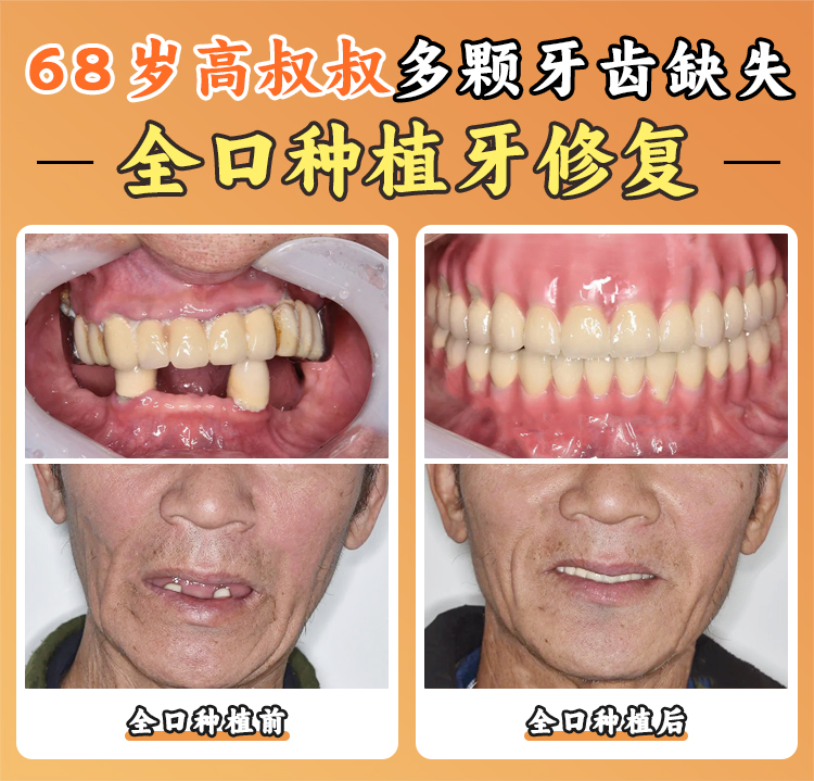品質優先選歐美品牌