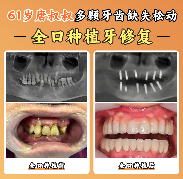 醫生團隊