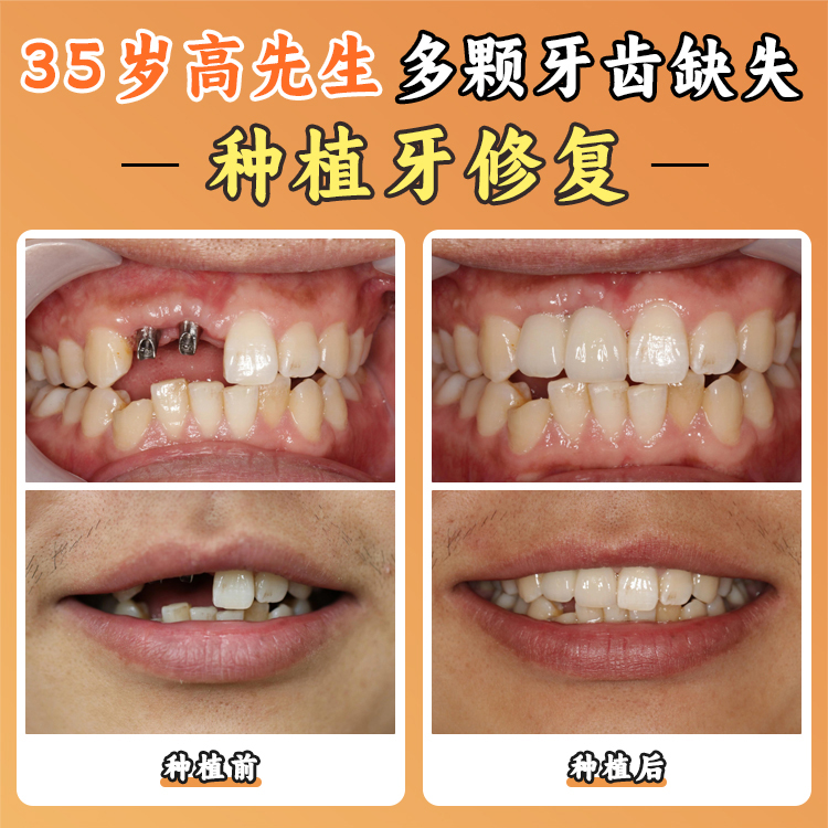 第二步：方案設計