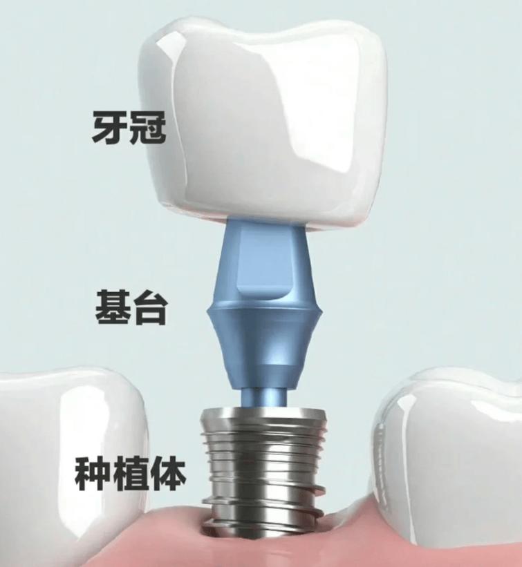 常见问题解答