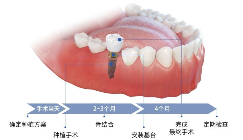 太原悦牙口腔的正规性与服务网络