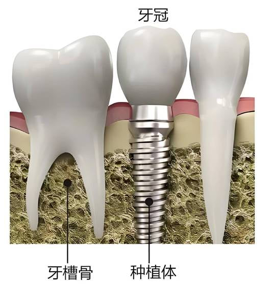 珠海瑞尔口腔看牙前你还需要知道的几件事 珠海瑞尔口腔看牙前你还需要知道的几件事