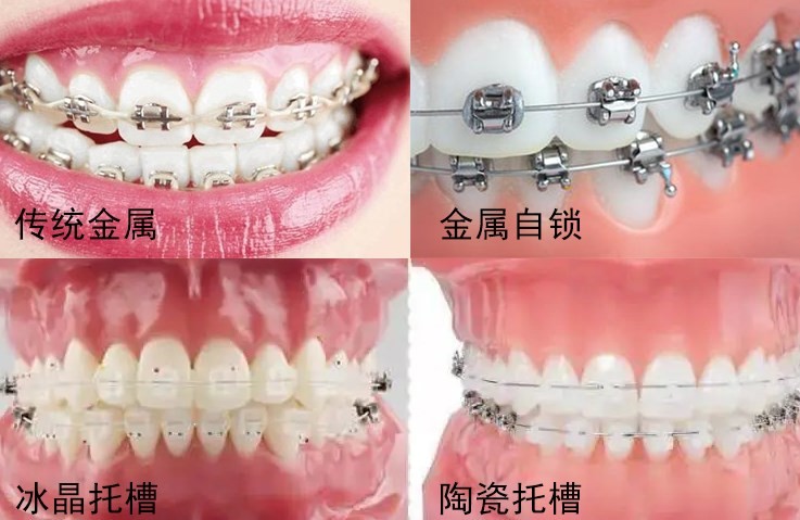 20260813214007.jpg 自锁与非自锁.jpg