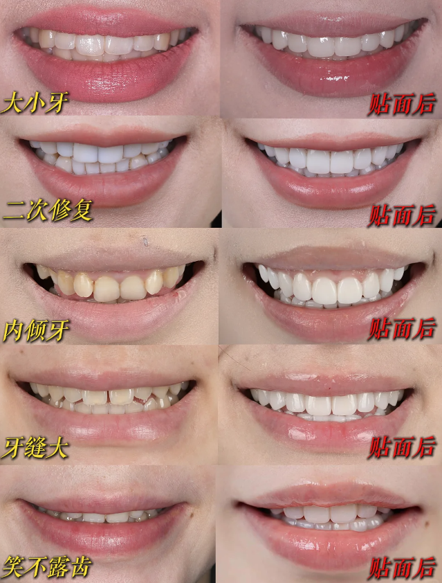 杭州美奥口腔城星院区：地铁口直达的靠谱私立齿科，用贝色查价预约更省心